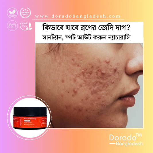 best affordable organic skincare, best organic skincare products, best skincare product for dark spots, best skincare brand in bangladesh, spot out treatment in bd, best acne spot treatment in bd, thanaka pack in bd